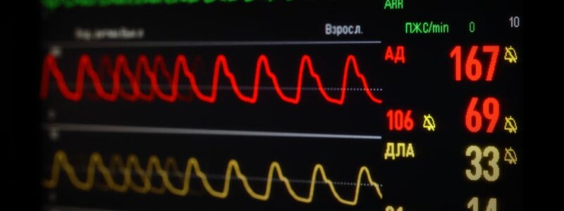 How Divorce Can Affect Heart Health, Especially for Women